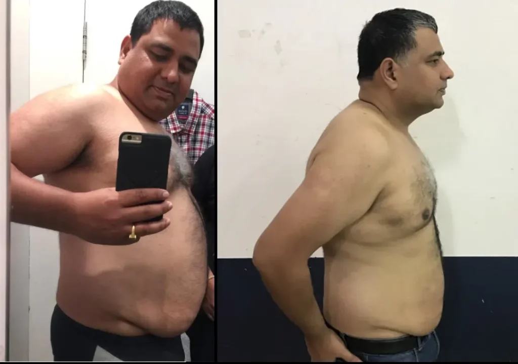 Hari's Before And After